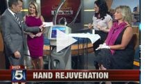 Hand Rejuvenation as seen on Fox 5 News (part 2)